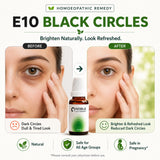 Dark Circles Care Kit | E10 Black Circles | Noble Life Energy