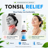 Tonsillitis Care Kit | E32 Tonsilla | Noble Life Energy