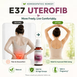 Uterine Fibroid Care Kit | E37 Uterofib | Noble Life Energy