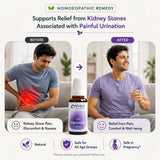 Kidney Stone Care Kit | E51 Renostone | Noble Life Energy