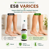 Varicose Veins Care Kit | E58 Varices | Noble Life Energy
