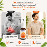 Fracture Healing Care Kit | E71 Fractus | Noble Life Energy