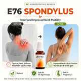 Cervical Spondylosis Care Kit | E76 Spondylus | Noble Life Energy