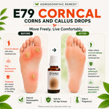 Corns and Callus Care Kit | E79 Corncal  | Noble Life Energy