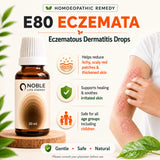 Eczema Care Kit | E80 Eczemata | Noble Life Energy