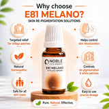 Vitiligo Care Kit | E81 Melano | Noble Life Energy