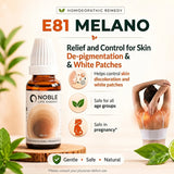 Vitiligo Care Kit | E81 Melano | Noble Life Energy
