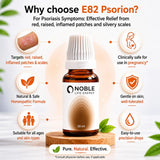 Psoriasis Care Kit | E82 Psorion | Noble Life Energy