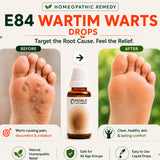 Warts Care Kit | E84 Wartim | Noble Life Energy