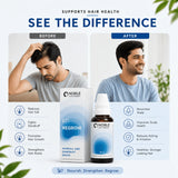 Hair Fall & Dandruff Care Kit | E21 Regrow | Noble Life Energy