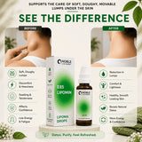 Lipoma Drops | E85 Lipomin | Noble Life Energy