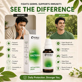 Anti Bacterial Drops | E91 Bacterin | Noble Life Energy