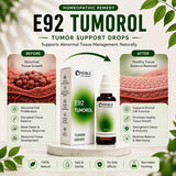Tumor Drops | E92 Tumorol | Noble Life Energy