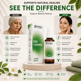 Tumor Drops | E92 Tumorol | Noble Life Energy